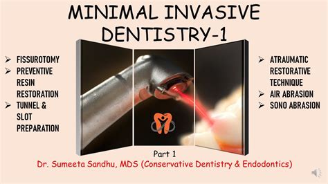 slot preparation in operative dentistry|Minimal Invasive Dentistry.